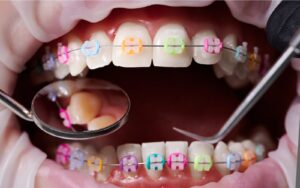 Dentures