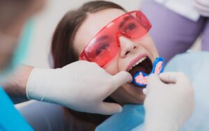 Dental Fluoride