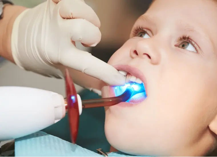 Pediatric Dental Sealants Richmond TX