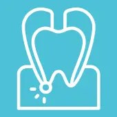 Pulpotomy Frenectomy​