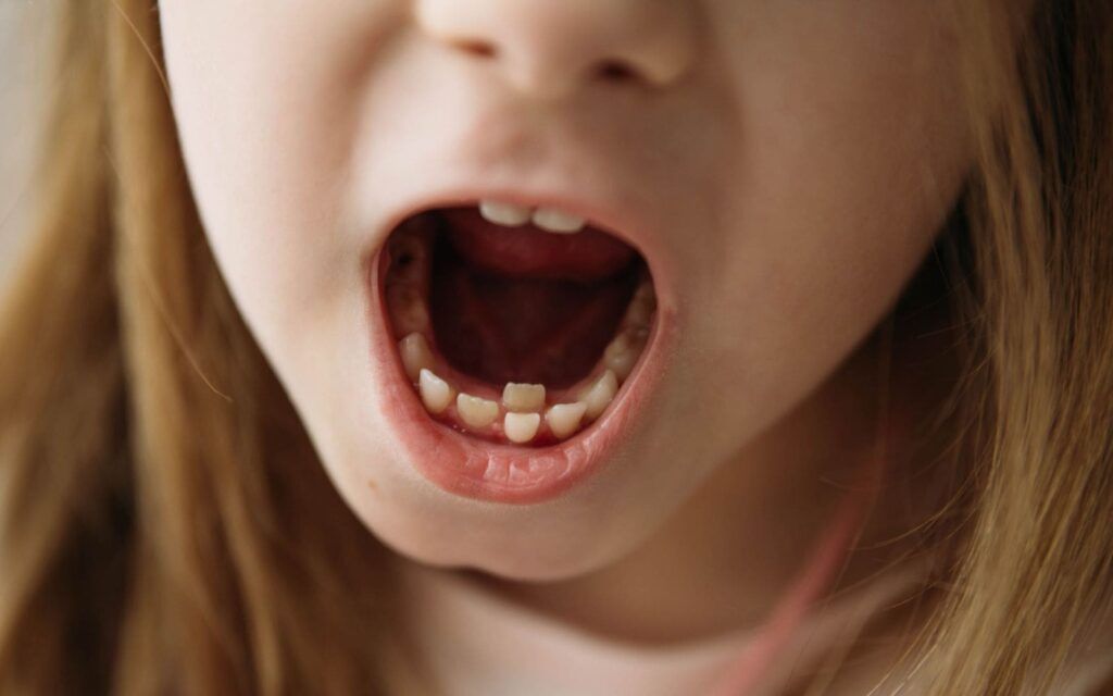 Child With Permanent Tooth Behind Baby Tooth